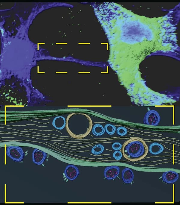 SARS-CoV-2's Potential Brain Invasion: Nanotube Bridges May Explain Neurological Symptoms