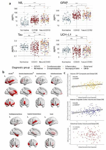 Landmark Study Reveals Persistent Cognitive Deficits in COVID-19 Survivors: Insights into Pathophysiology and Potential Therapeutic Avenues