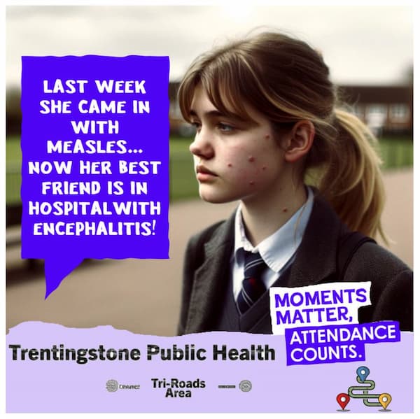 Urgent Alert: Measles Outbreak Hits Trentingstone - Encephalitis Lands Another in Hospital