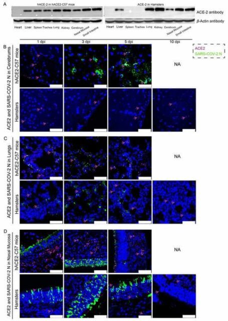 SARS-CoV-2 Viral Distribution in Cerebrum and Lungs: Insights from Transgenic hACE2-C57 Mice Study